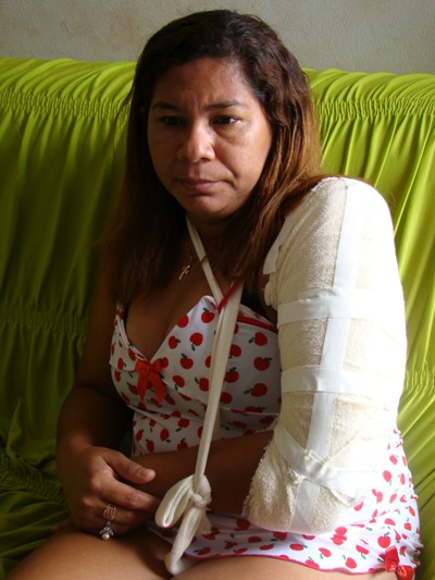 TINA E A AGRESSÃO 2